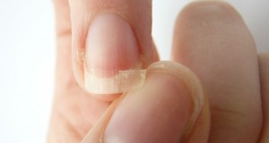 How to make your nails harder – Homemade DIY tips